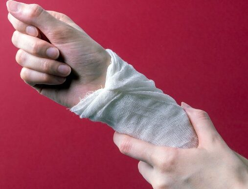 person's hand bandaged with medical gauze after a burn
